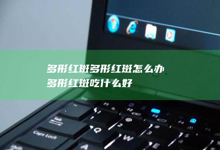多形红斑_多形红斑怎么办_多形红斑吃什么好_多形红斑的症状