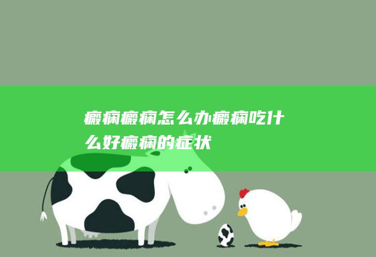 癜痫_癜痫怎么办_癜痫吃什么好_癜痫的症状